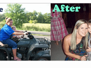 Weight Loss Before and After Picture