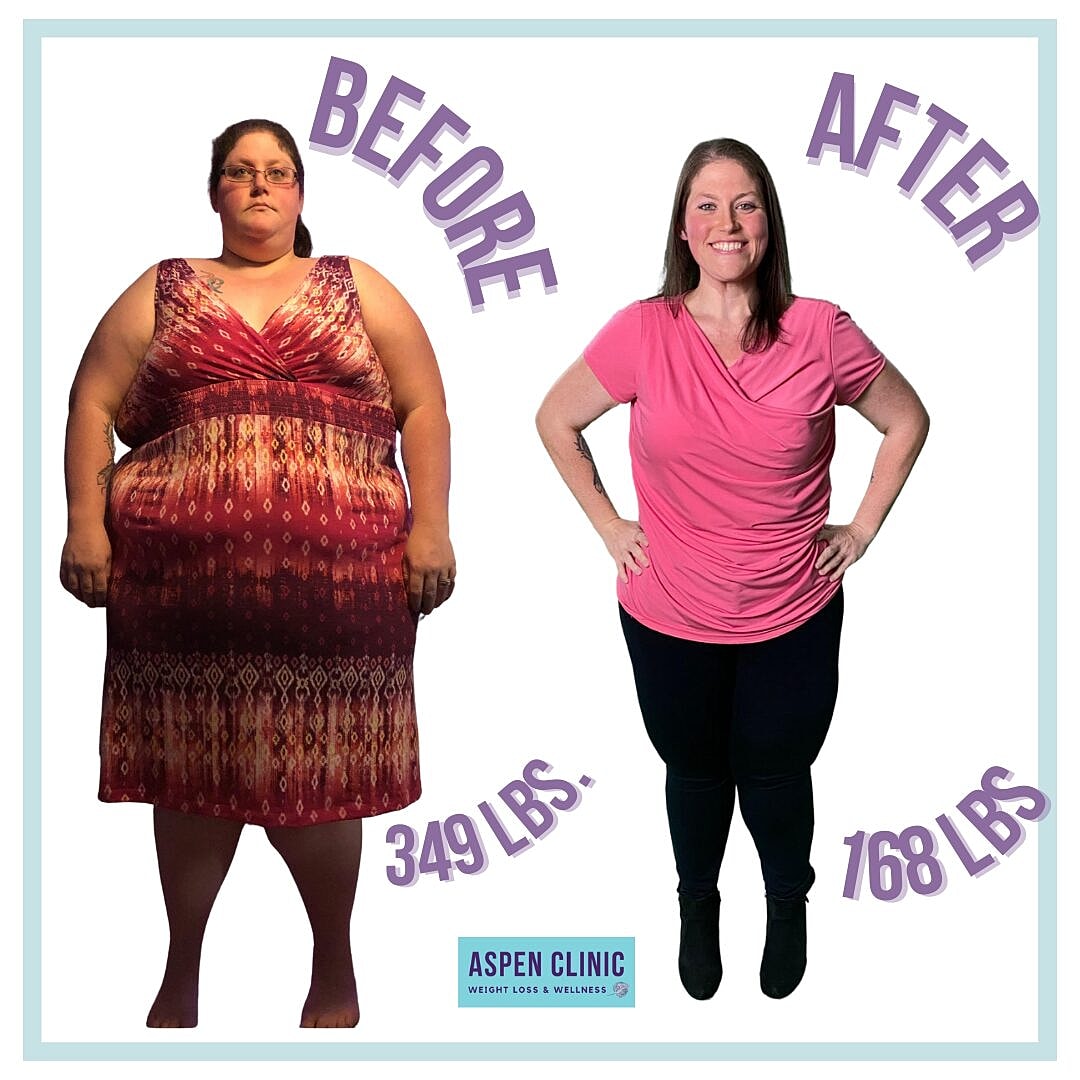 Weight Loss Before and After Pictures Before & After