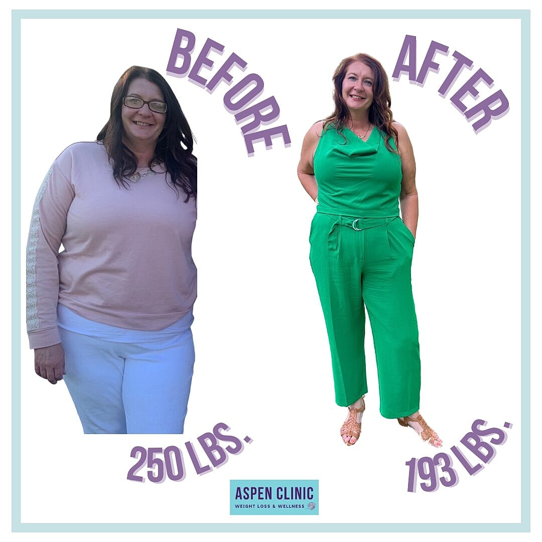 Weight Loss Before and After Pictures Before & After