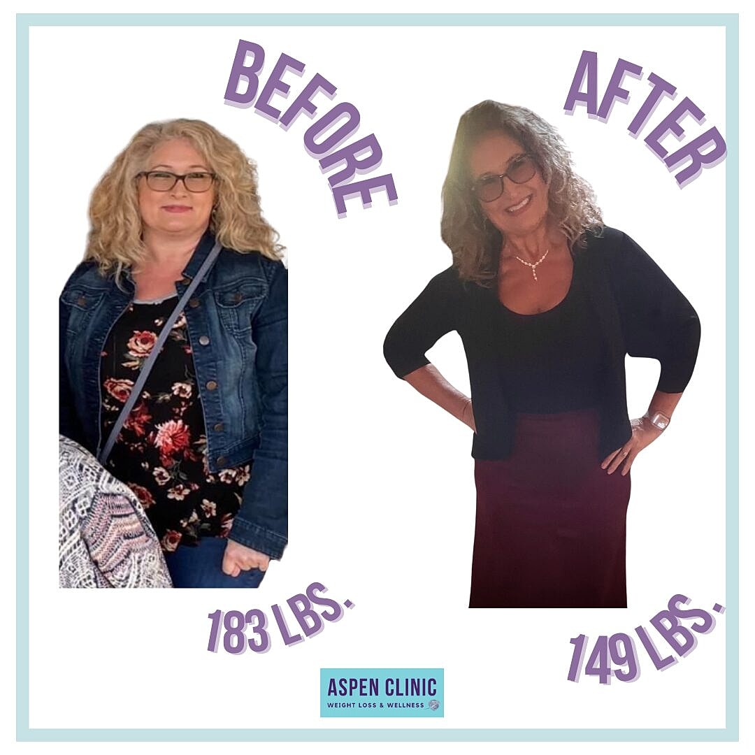 Weight Loss Before and After Pictures Before & After