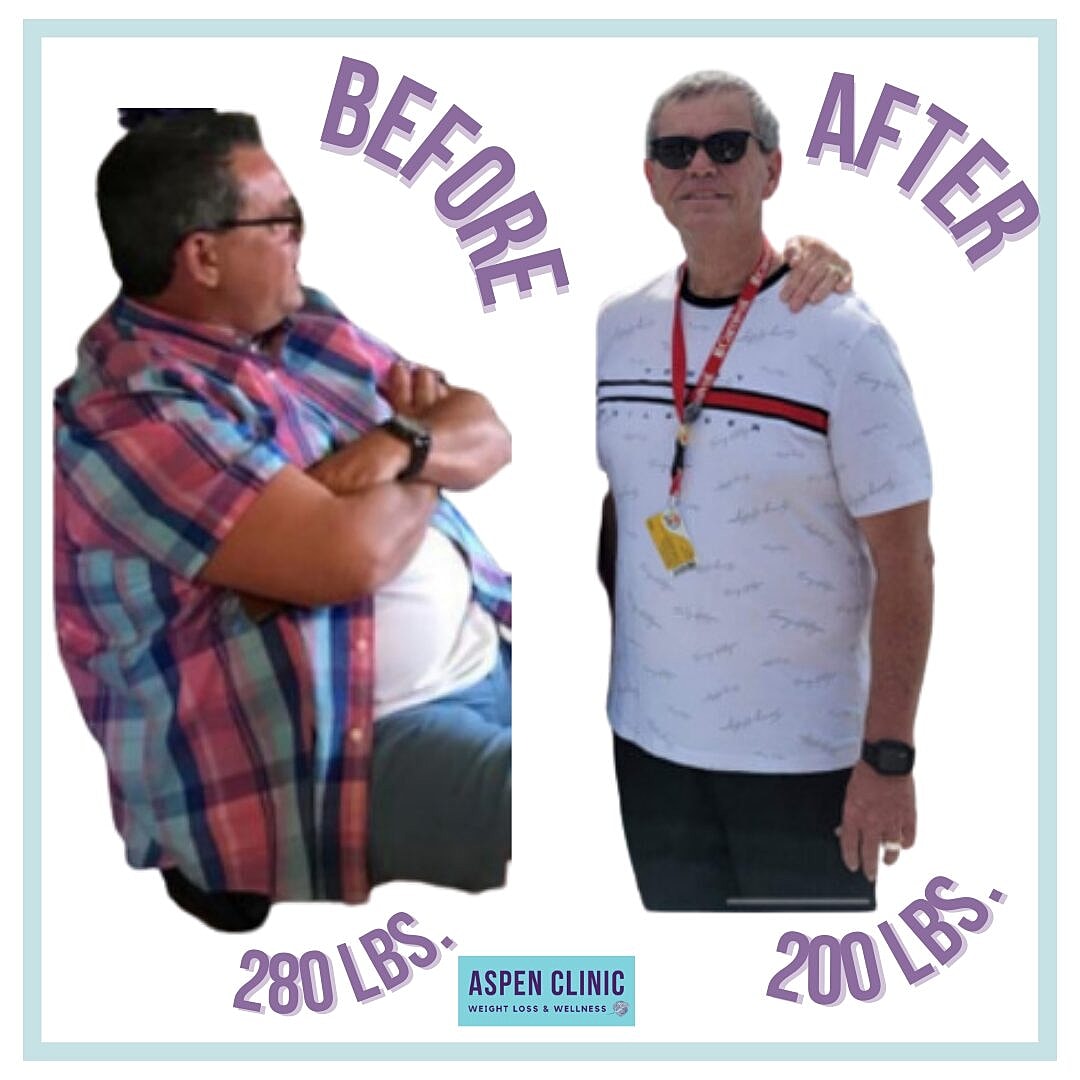 Weight Loss Before and After Pictures Before & After